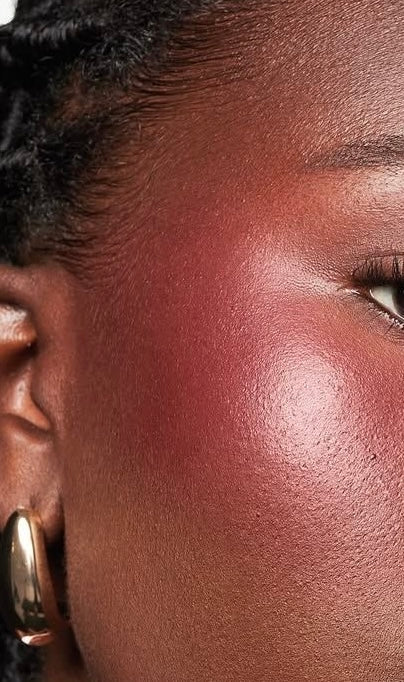 Manage acne-prone skin with A Star cosmetics - A STAR COSMETICS