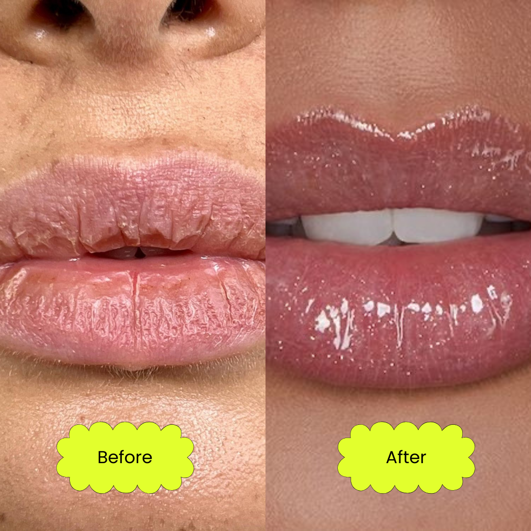 A picture of a woman with dry, dehydrated lips and this is labelled "Before" and a picture of a woman with hydrated glossy shimmering lips and this is labelled with "after"