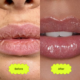 A picture of a woman with dry, dehydrated lips and this is labelled "Before" and a picture of a woman with hydrated glossy shimmering lips and this is labelled with "after"